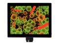 Mikroskopový digitálny fotoaparát Levenhuk 5M s LCD obrazovkou 9,4"